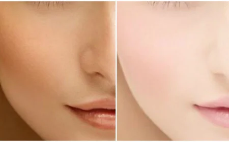 The Latest Skin Whitening Technologies in Dubai: Immediate and Safe Results