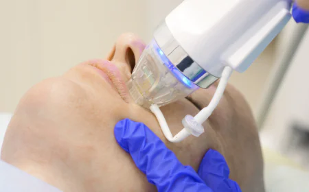 How Often Should You Get RF Micro Needling