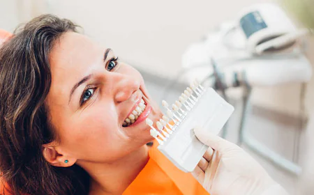 Teeth Whitening Cost: Is Professional Whitening Worth It?