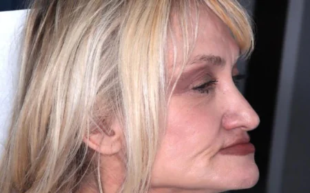 How Can Class III Bite Correction Influence the Appearance of a Protruding Chin?
