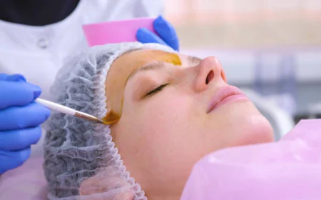 How can Chemical Peels refresh a tired-looking complexion?
