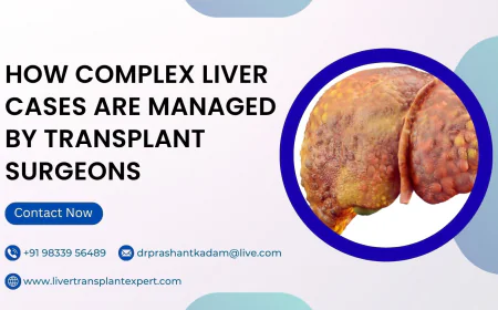 How Complex Liver Cases Are Managed by Transplant Surgeons