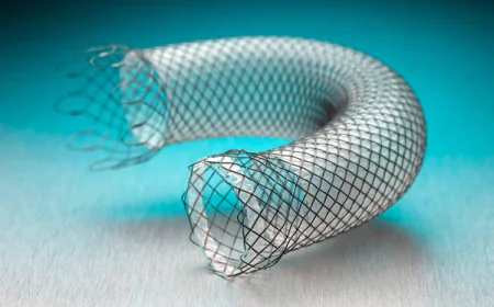 Gastrointestinal Stents Market Size, Trends, and Strategic Growth Analysis 2026-2033