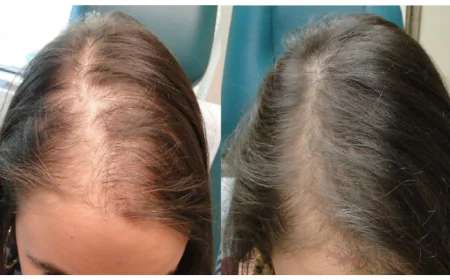 What Can Help Women Maintain Thicker Hair?