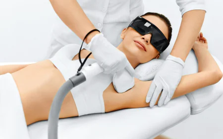 Laser Hair Removal in Delhi: How It Works, Who Can Do It and What to Expect