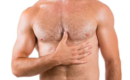 Does Gynecomastia Surgery help achieve a masculine chest?