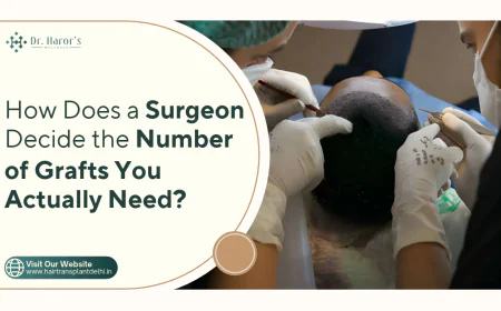 How Does a Surgeon Decide the Number of Grafts You Actually Need?