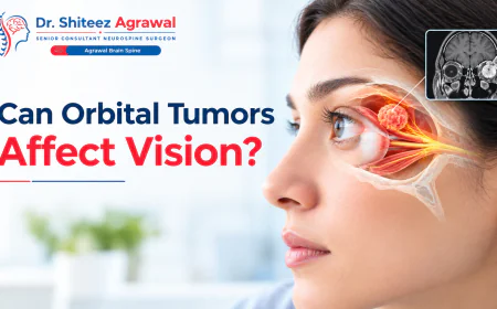 Can Orbital Tumors Affect Vision? Symptoms, Causes, and Treatment Options