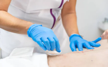 What Can Skin Lesion Removal Treat?