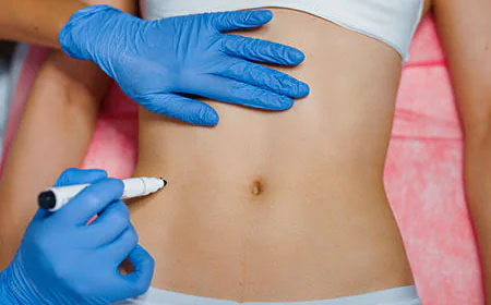 What Can Body Fillers Do for Body Shape?