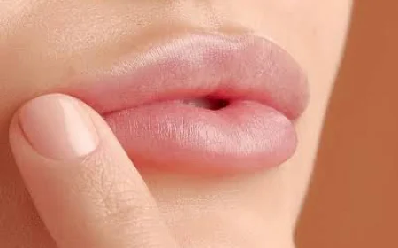 Can Lip Augmentation Improve Age-Related Lip Volume Loss?