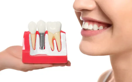 Improve Your Oral Health with Dental Implants in Panacea, FL