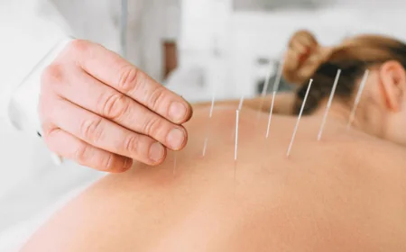 What Is Acupuncture for Stress and Anxiety and How Can It Help?