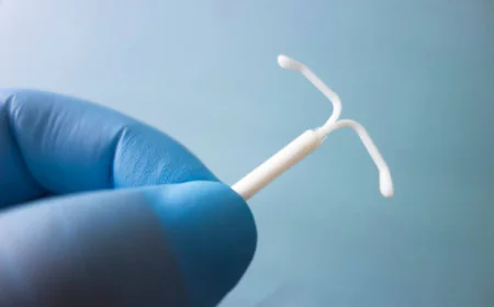 What Are the Main Benefits of an IUD for Contraception