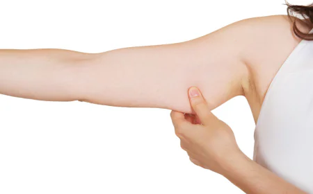 Does Arm Lift Surgery Tighten Loose Skin?