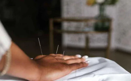 Orthopedic Acupuncturist in Oakland: Private vs Community
