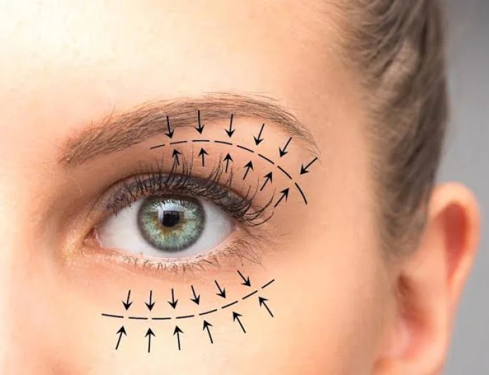 Upper Blepharoplasty In Dubai: Refresh And Define Upper Eye Contours