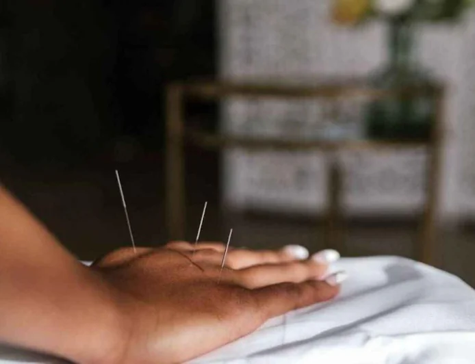 Orthopedic Acupuncturist in Oakland: Private vs Community