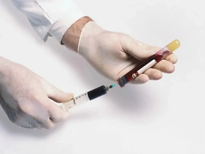 What to Know Before Getting a Hepatitis C Test