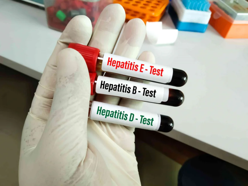 What to Know Before Getting a Hepatitis B Test