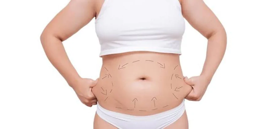 How does Mini Abdominoplasty address belly laxity?