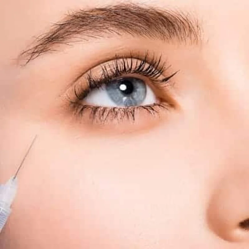 Can Under Eye Fillers Improve the Look of Dark Circles?