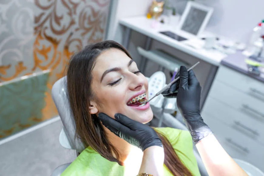 Dental Braces: Types and Options Explained