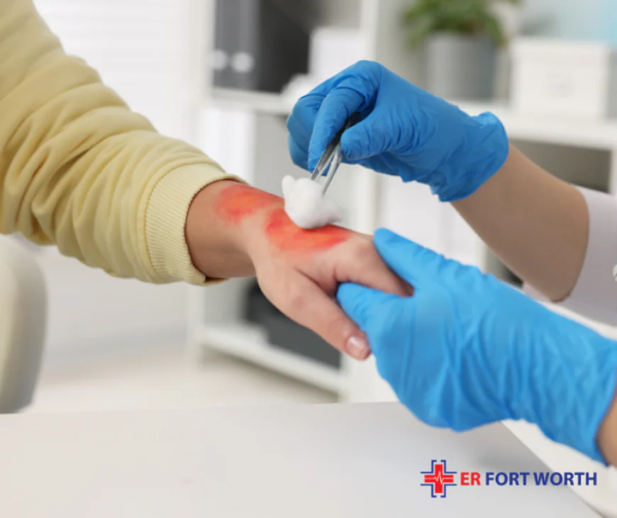Minor Burn Treatment: Essential Steps for Safe Burn Care