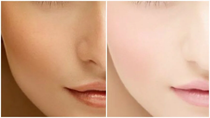 The Latest Skin Whitening Technologies in Dubai: Immediate and Safe Results