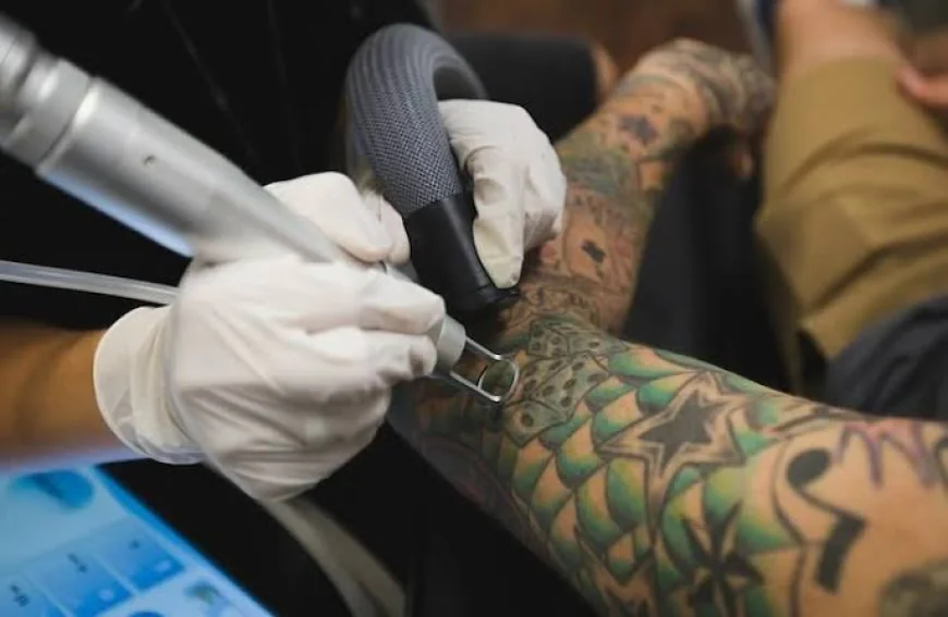 How long does Laser Tattoo Removal take to show changes?
