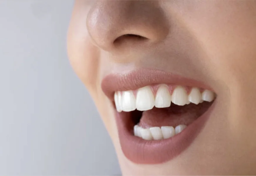 Restore Your Smile Naturally with Tooth-Colored Fillings