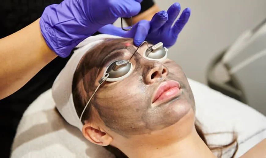 Does Laser Carbon Peel Make Skin Look Younger?