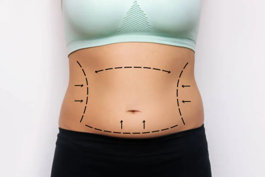Can Tummy Tuck Surgery remove loose lower belly skin