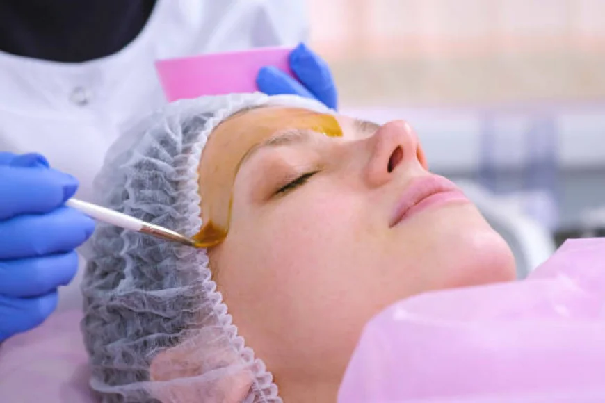 How can Chemical Peels refresh a tired-looking complexion?