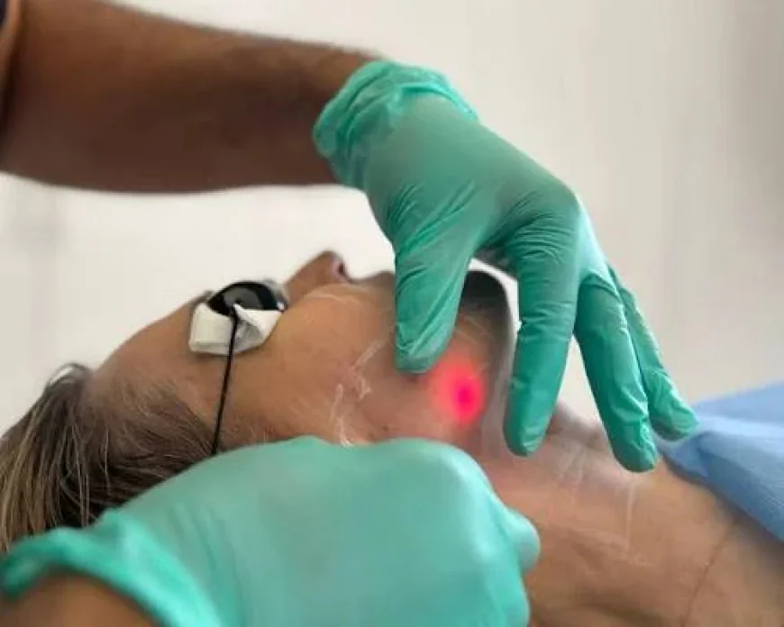 How Does Endolift Improve Facial Firmness?