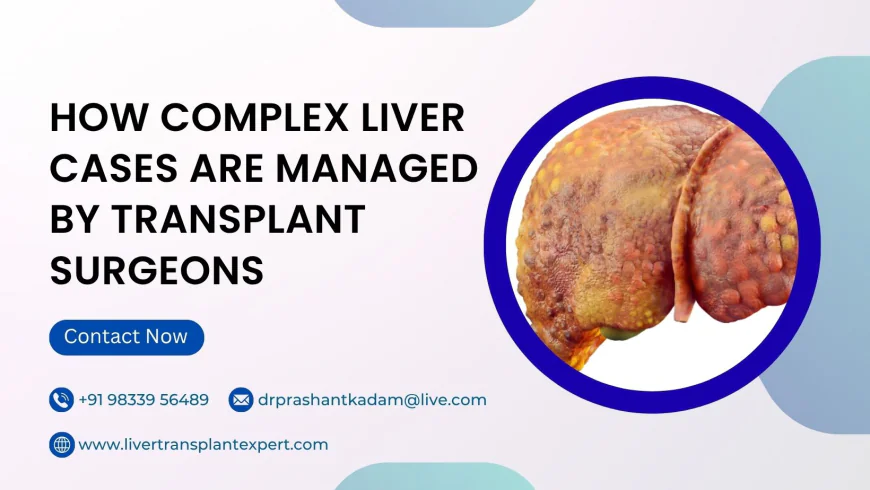 How Complex Liver Cases Are Managed by Transplant Surgeons