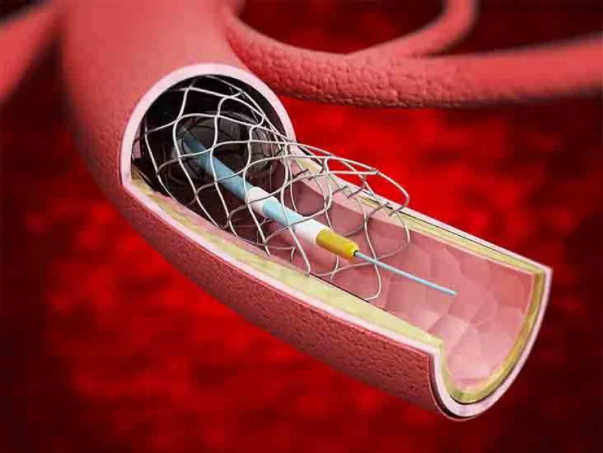 Transcatheter Embolization And Occlusion Devices Market Growth and Dynamics Analysis