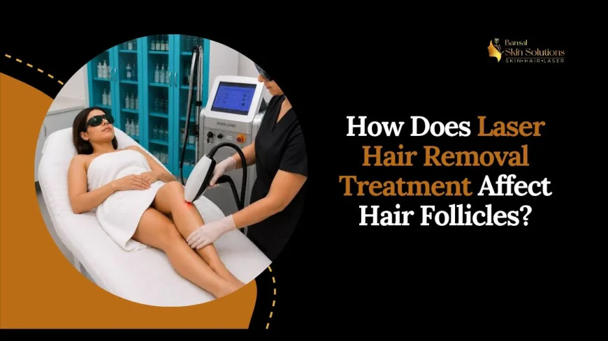 How Does Laser Hair Removal Treatment Affect Hair Follicles?