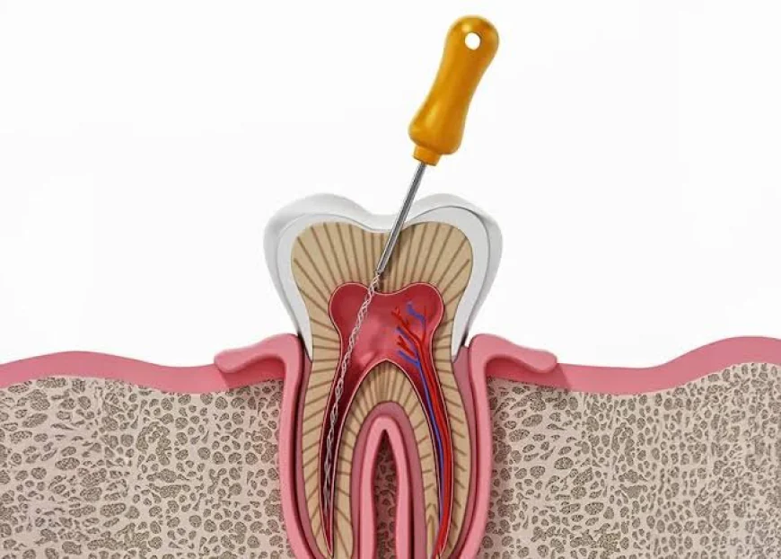 Infected Tooth Pulp: When a Root Canal Is the Right Choice