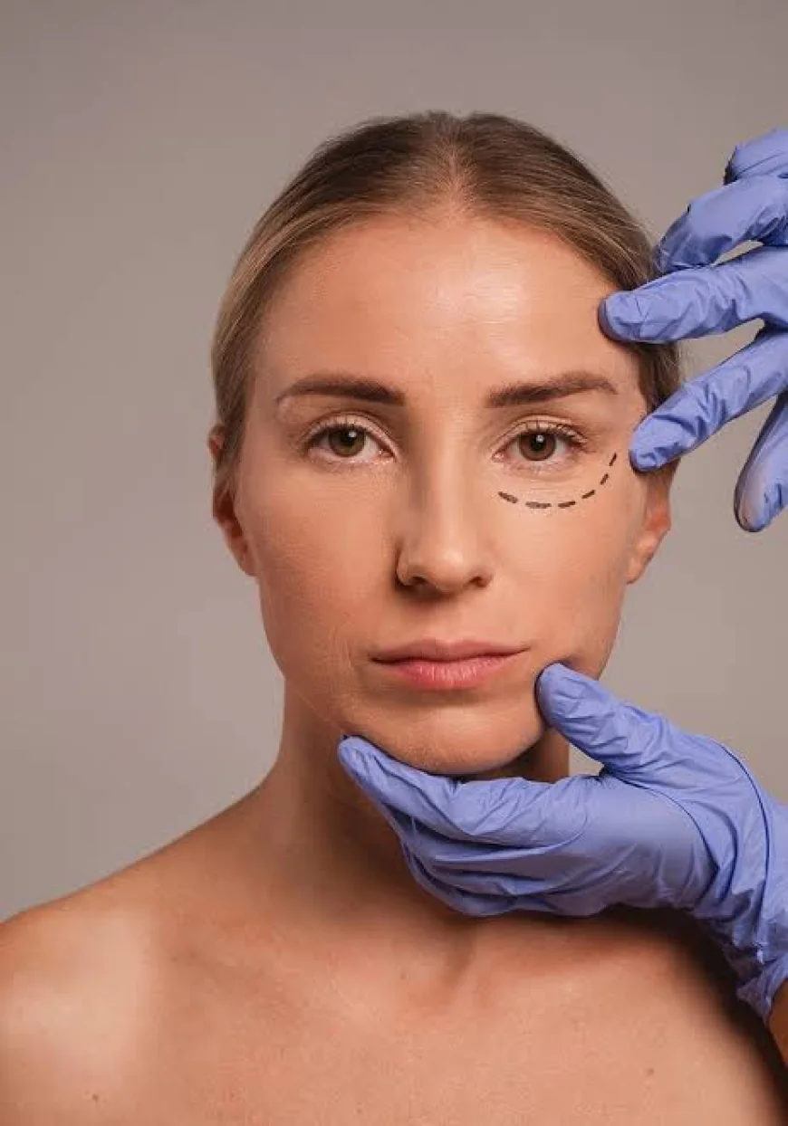 Is Eyelid Surgery helpful for a more defined eye contour?