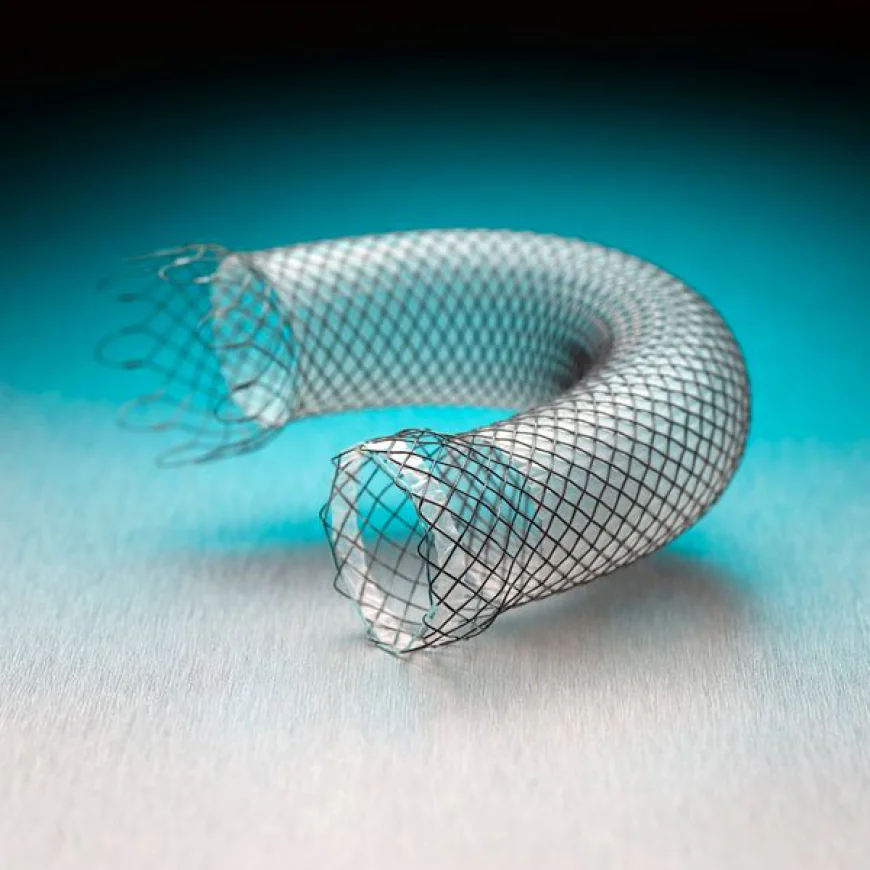 Gastrointestinal Stents Market Size, Trends, and Strategic Growth Analysis 2026-2033