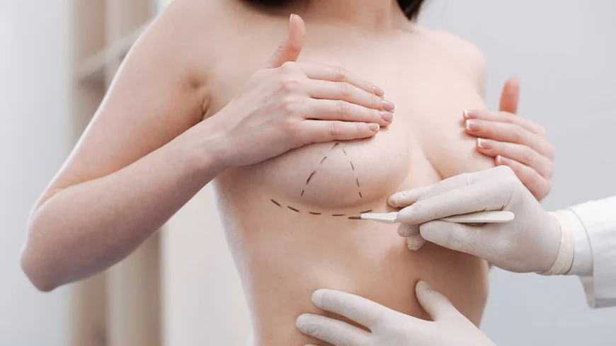 What to Know Before Inverted Nipple Surgery