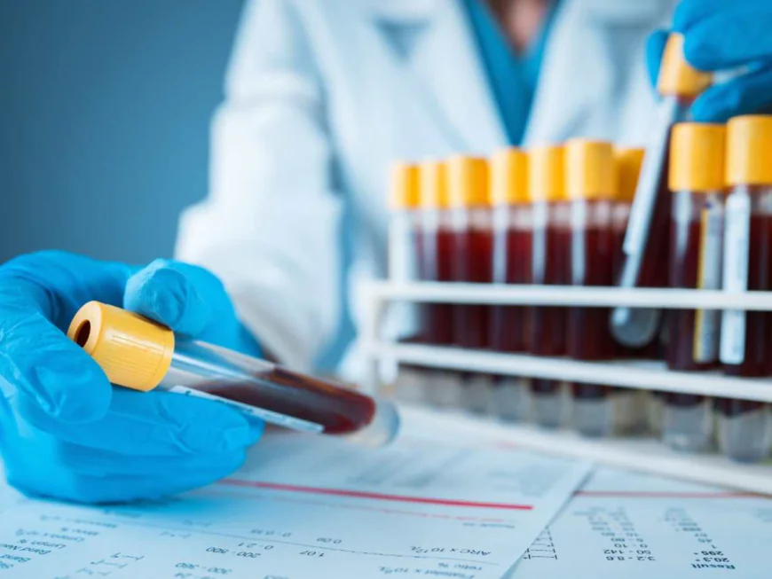 What to Know Before Getting a Hepatitis C Test