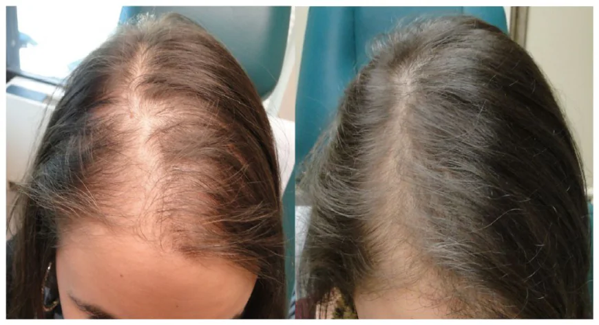 What Can Help Women Maintain Thicker Hair?