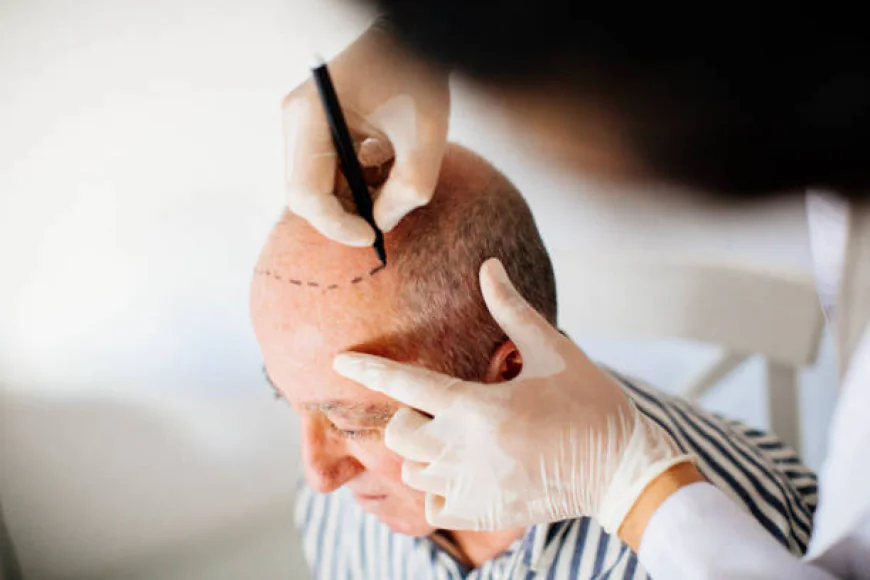 How can Hair Transplant address uneven hair growth?