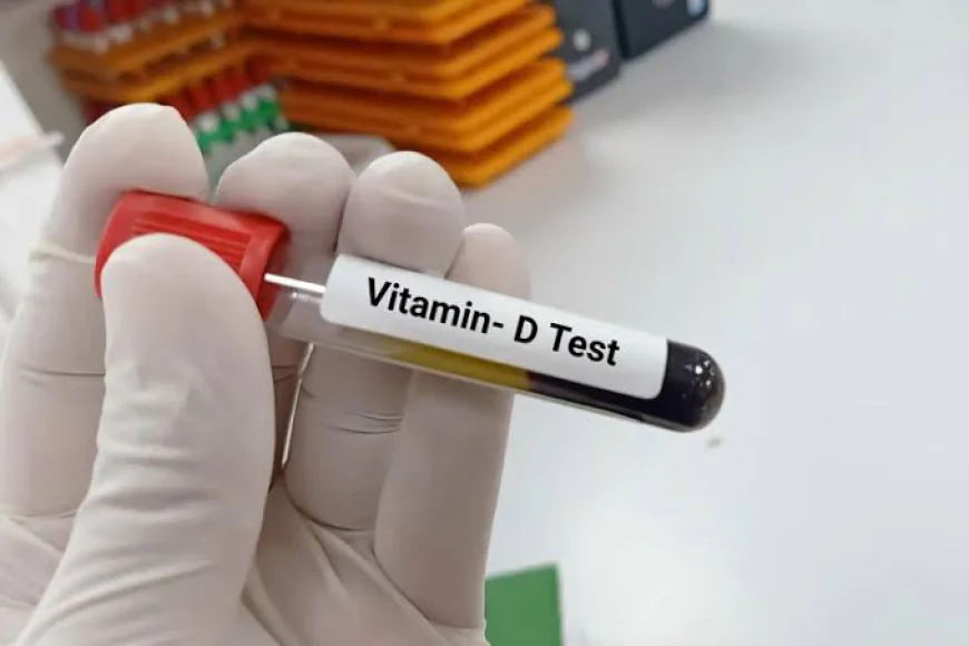 Vitamin D Tests At Home for Busy People