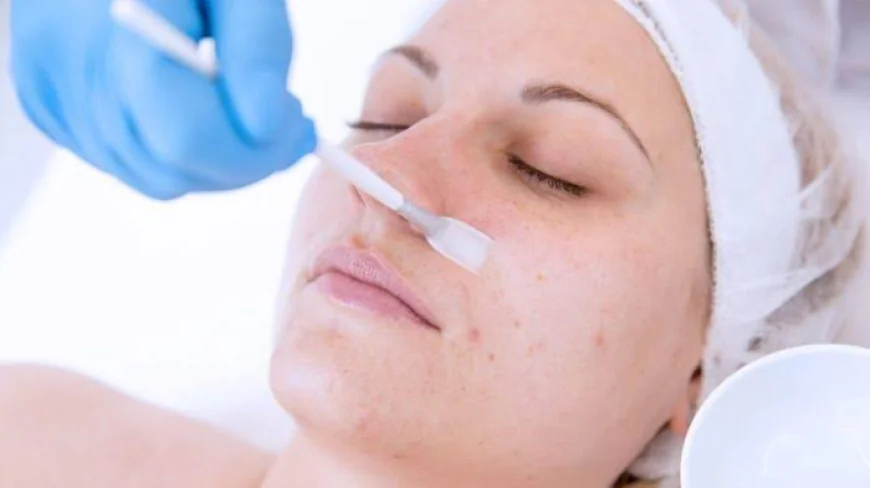 Is Large Pores Treatment Suitable for Acne-Prone Skin?