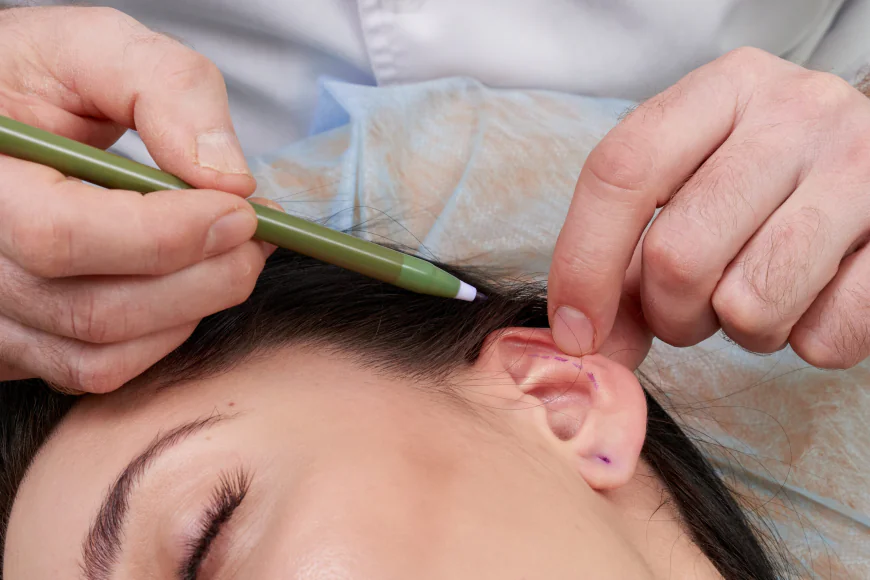 Microtia in Children: What Parents Should Know About Ear Surgery