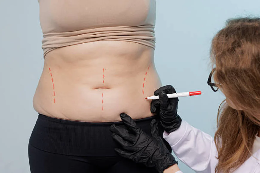 Can Laser Liposuction Help With Resistant Love Handles