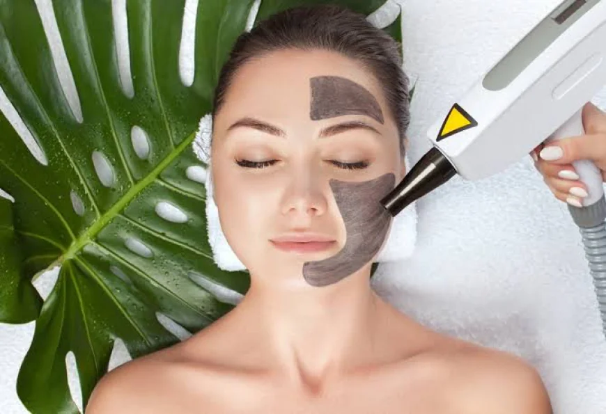 Is Laser Carbon Peel suitable for enhancing overall skin clarity?